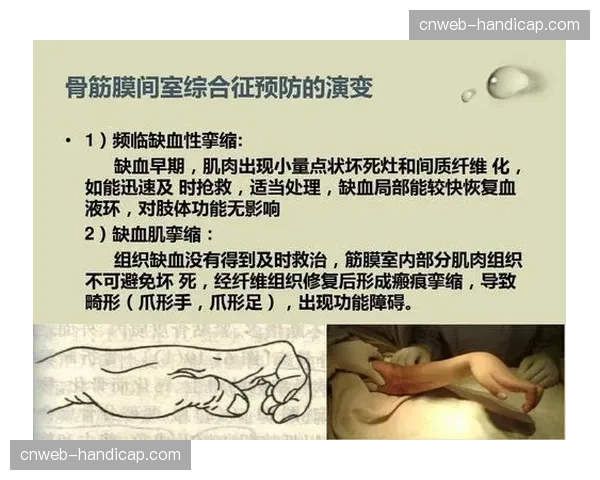 医学观察：三月密集赛程下，球员肌肉疲劳与拉伤风险增加，如何平衡高强度转换需求？